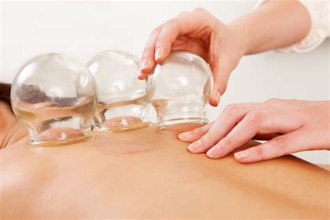 Is Cupping For You Things You Should Know About The Treatmentwholeself Acupuncture
