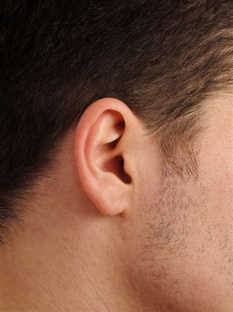 Protruding Ears Answers On Healthtap