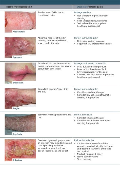 Wound Care 2018 On Twitter Various Types Of Tissue Found In The Wound