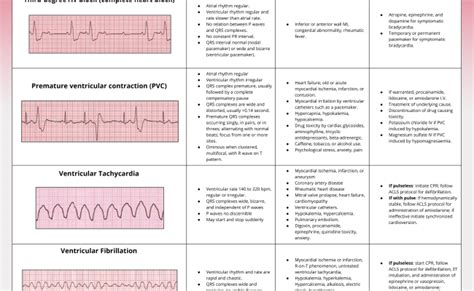 Ekg Examples Of Interpretation Cardiac Nursing Ekg Interpretation Cheat