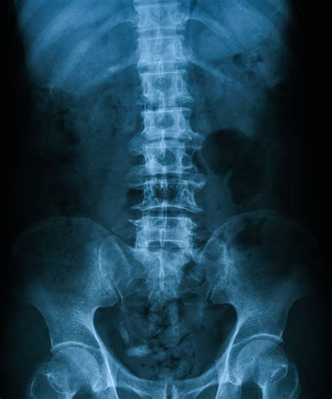 X Ray Kub Stock Photos Pictures And Royalty Free Images Istock