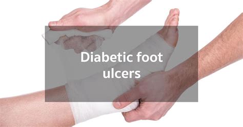 How Can Diabetes Affect The Feet