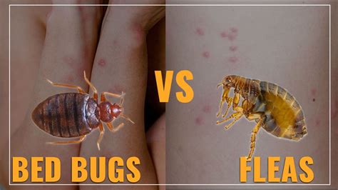 Flea Bites Vs Bed Bug Bites How To Tell Them Apart Why It Matters My Xxx Hot Girl