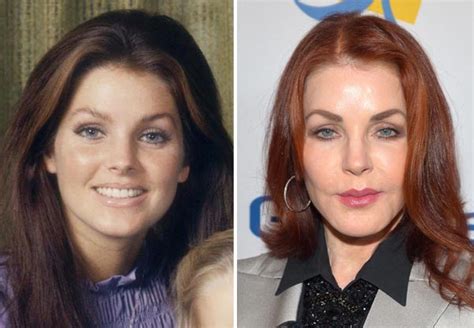 Priscilla Presley Plastic Surgery Disaster With Images