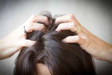 Female Hair Loss Causes – Hair Loss Tips For Women – Viral Rang