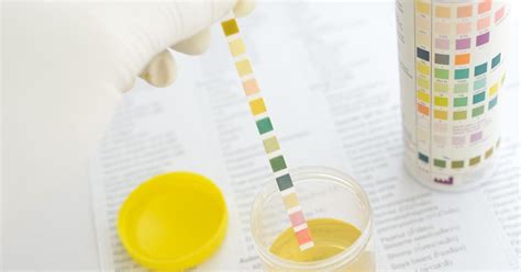 There are many different reasons for high leukocytes in urine varying in severity. Leukocytes in Urine: What Does Leukocyte Esterase in Urine ...