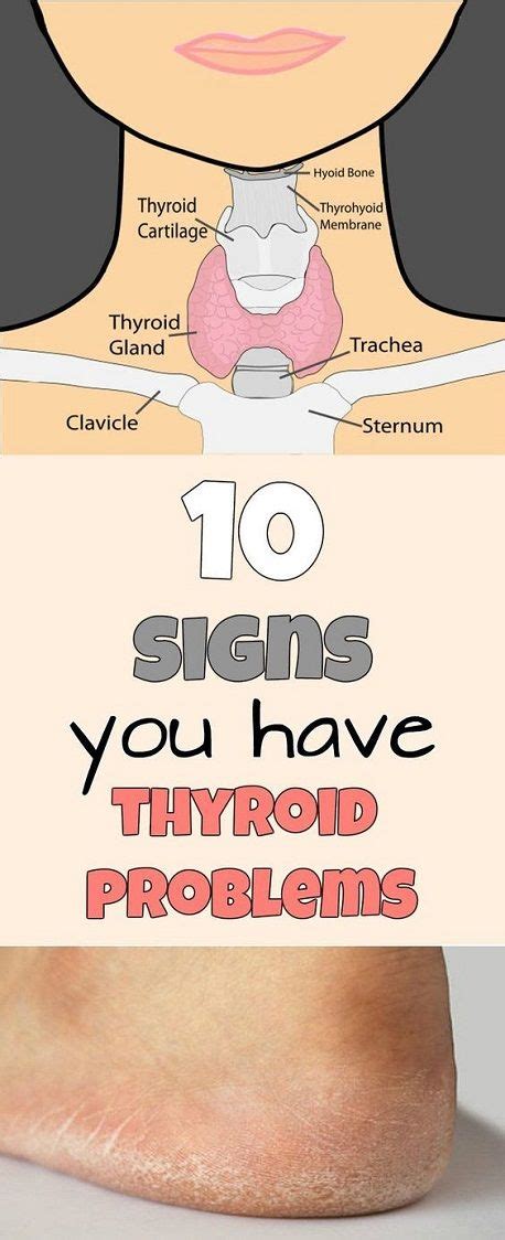 8 Signs That Indicate Problem With Thyroid Gland Fit And Healthy