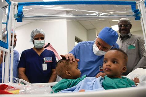 Saudi Surgeons Separate Nigerian Conjoined Twins Vanguard News