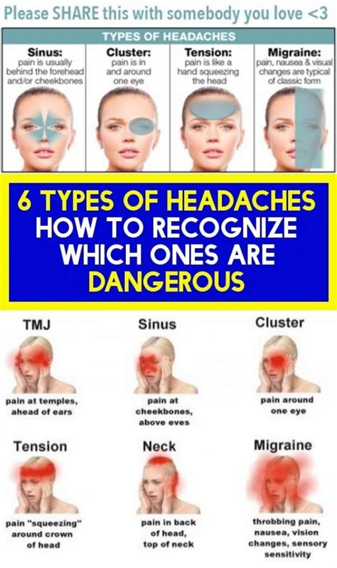 6 Headaches Types How To Know Which Ones Are Dangerous Headache