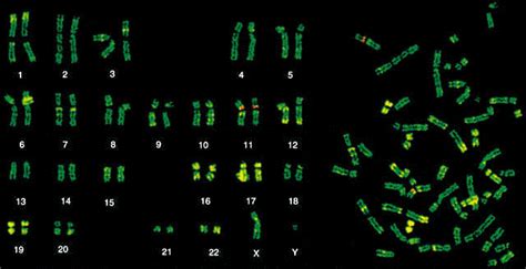 Chromosome Banding Uvm Genetics And Genomics Wiki Fandom Powered By Wikia