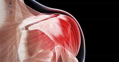 It's no surprise that the anatomy of your back is very complex in of itself since you rely on it for many different things. How to Heal Pulled Muscles