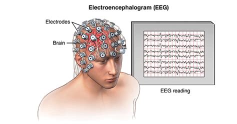 Electroencephalography Pronunciation