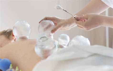 Cupping Therapy Faqs What Who Where Common Qandas