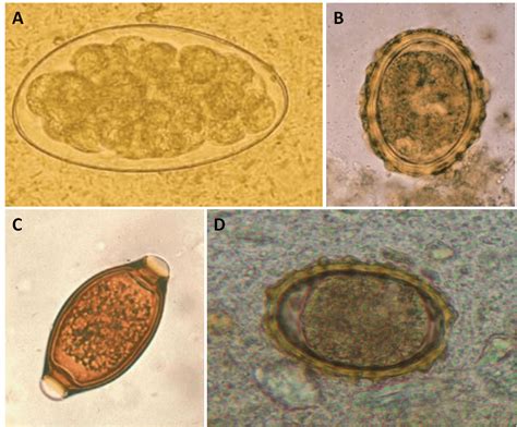 Trichostrongylus Colubriformis Scheda Parassitologica E Approfondimenti