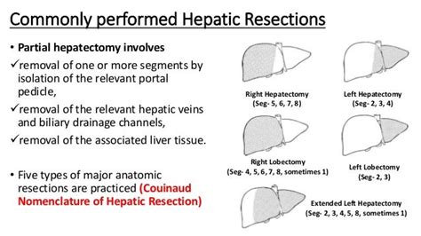 Benign Neoplasms Of Liver