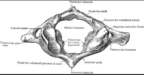 Global issues surrounding physical activity learn more about physical activity around. ORTHOPAEDICS: Atlantoaxial spine