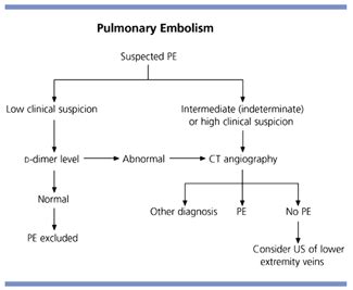 Diagnosis: Pulmonary Embolism Diagnosis