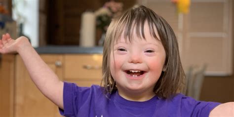 Down Syndrome Symptoms And Its Types