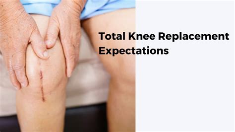 Total Knee Replacement Expectations Knee Replacement Recovery Tips