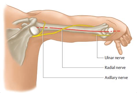 22 Humeral Shaft Fractures Musculoskeletal Key