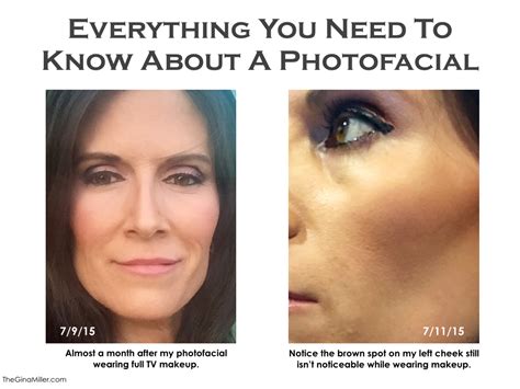 Photofacial Review Everything You Need To Know About This