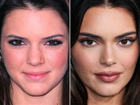 Kendall Jenner Before And After From To The Skincare Edit