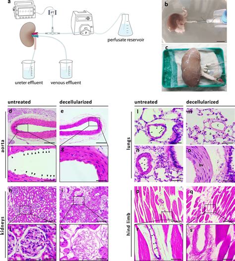 Ex Vivo Perfusion Of Rat And Porcine Organs And Decellularization Of