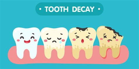 Top Causes Of Tooth Decay Symptoms And Treatment