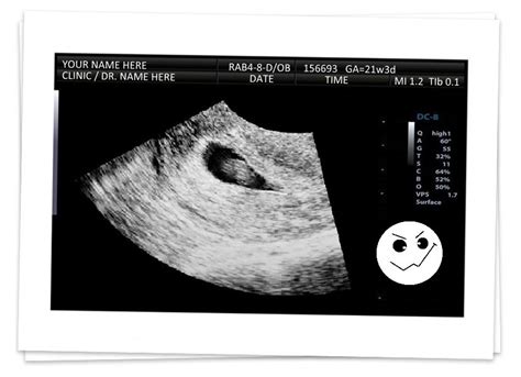 realistic ultrasounds fake ultrasound sonogram pranks