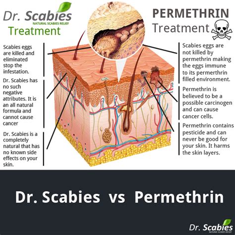 Why Scabies Can Become Immune To Permethrin Best