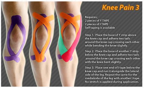 Knee Pain Knee Pain Kinesiology Taping Instructions For Knee Pain Kta