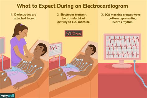 Puskesmas Lumbir Procedure Pemasangan Ekg Ecg Electrocardiogram My