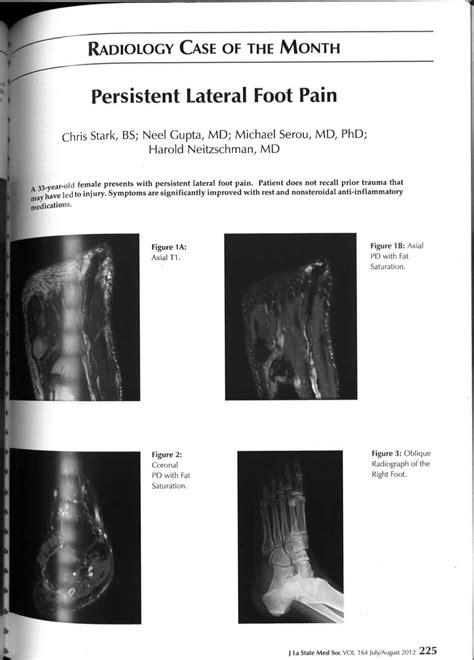 Pdf Radiology Case Of The Month Persistent Lateral Foot Pain