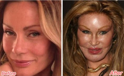 Get To Know The Socialite Jocelyn Wildenstein Before Her Disastrous
