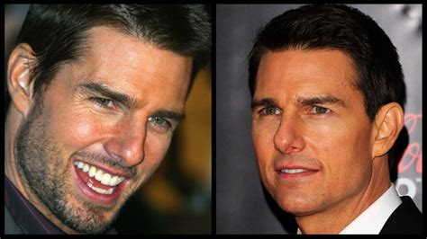 Total 42 Imagen Tom Cruise Skin Vn