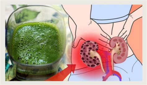 It works the same way as other same day detox drinks in that it only tries to mask the thc and toxins. How to Cleanse and Detox the Kidneys Naturally at Home