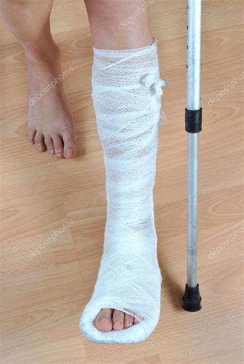 Broken Leg — Stock Photo © Kilukilu 5227352