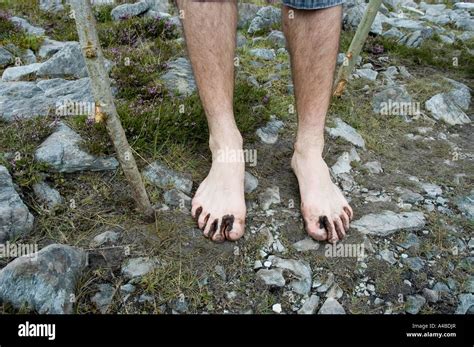 A Pilgrim Climbs Croagh Patrick Barefoot County Mayo Ireland Stock