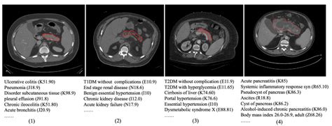 Pancreas Ct Segmentation By Predictive Phenotyping Medical Image