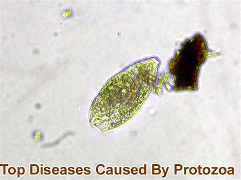 Top 12 Diseases Caused By Protozoa Malaria Trypanosomiasis And More