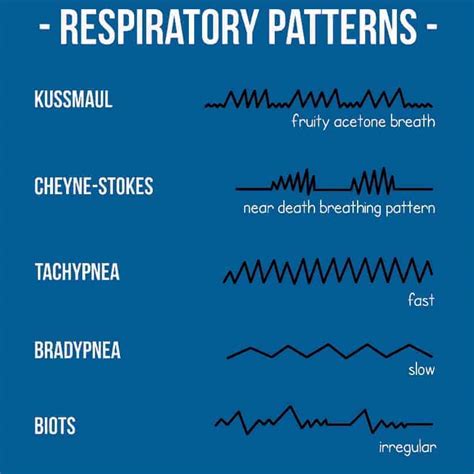Monitoring respiratory rate in adults. Do I really need to count a patients respiratory rate for ...