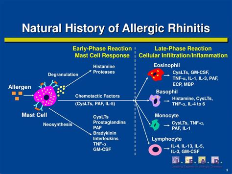 Ppt Allergic Rhinitis Powerpoint Presentation Free Download Id1437518