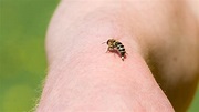 Treating a Bee Sting | Tips by Fantastic Pest Control Australia