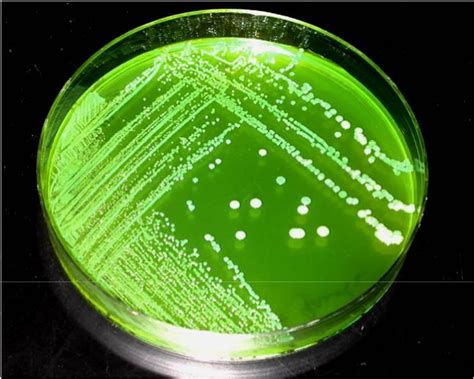 Prepared Media Agar Plates Preparedbio