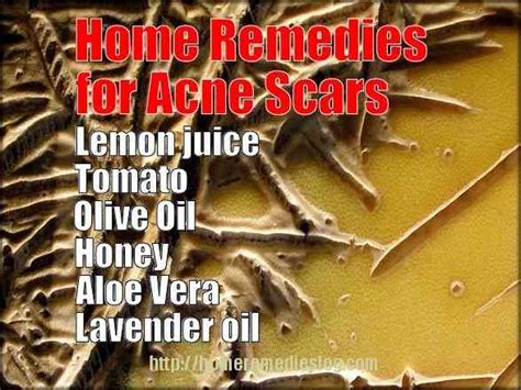 Scars can form during the end stage of acne. Home Remedies for Acne Scars - Natural Treatments that ...