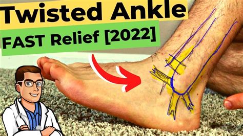 Fix Twisted Ankle Rolled Ankle Or Sprained Ankle Ligaments Faster