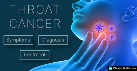 10 Symptoms Of Throat Cancer You Mustnt Ignore India
