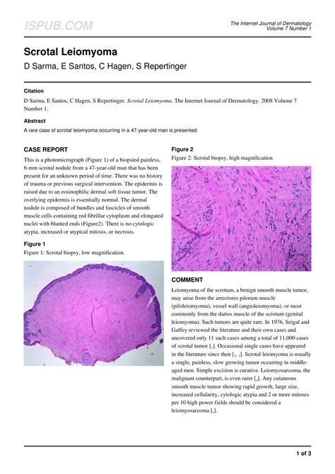 Pdf Palisaded Encapsulated Neuroma Pen