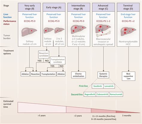 Hepatocellular Carcinoma NEJM