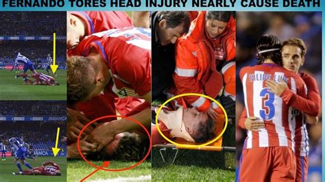 Fernando torres pulls his hamstring while chasing the ball. Fernando Torres Horrible Head Injury - Deportivo La Coruna vs Atletico M... | Deportivo la ...